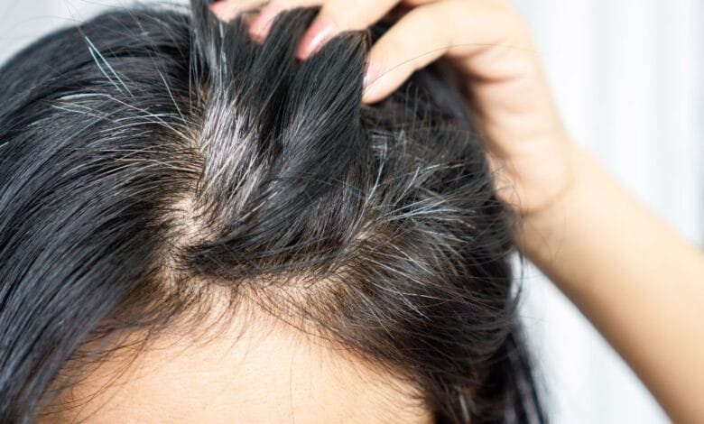 Reverse Grey Hair, Grey hair treatment